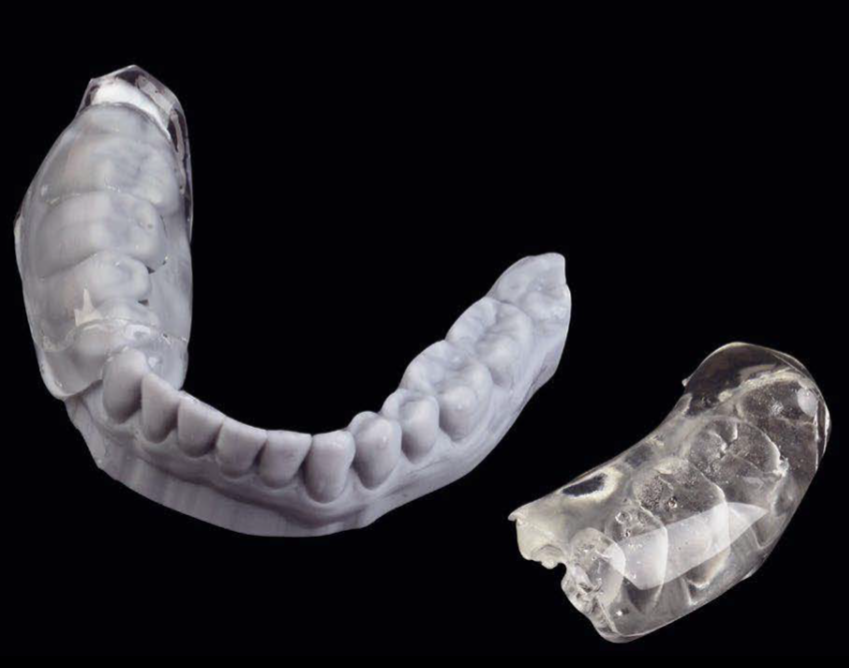 Fig. 1: Printed model and silicone index.